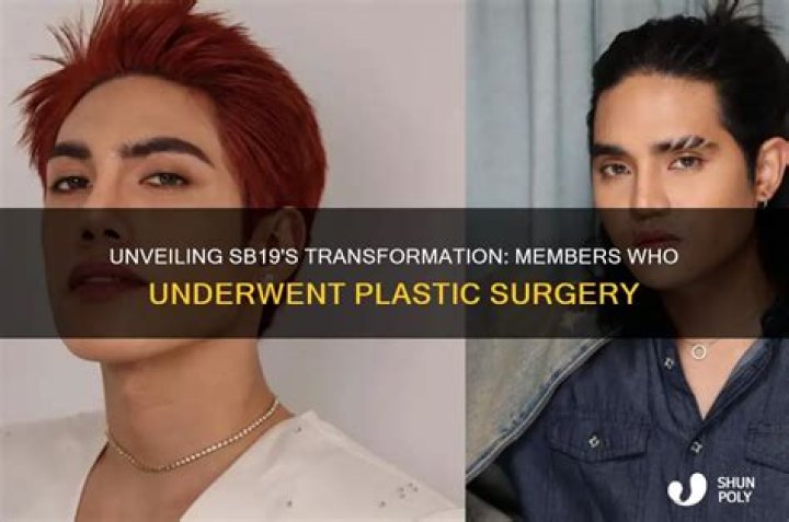 5 Astonishing Revelations About SB19 Plastic Surgery Procedure