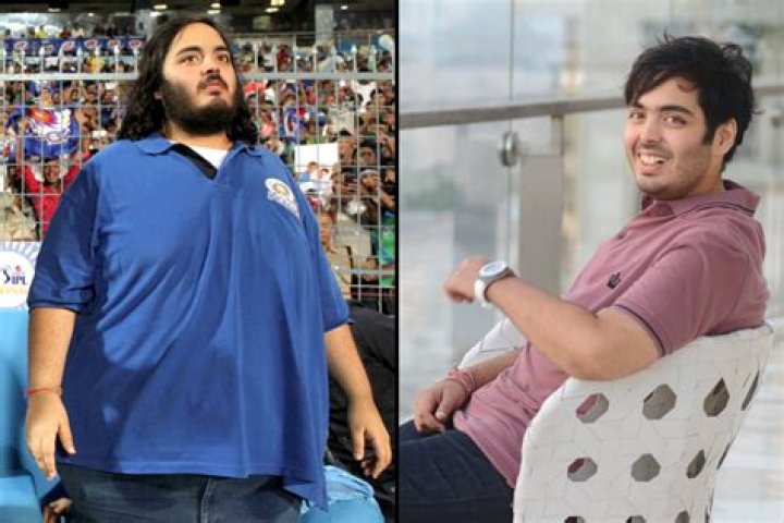 Anant Ambani's Health Journey: Understanding His Diagnosis