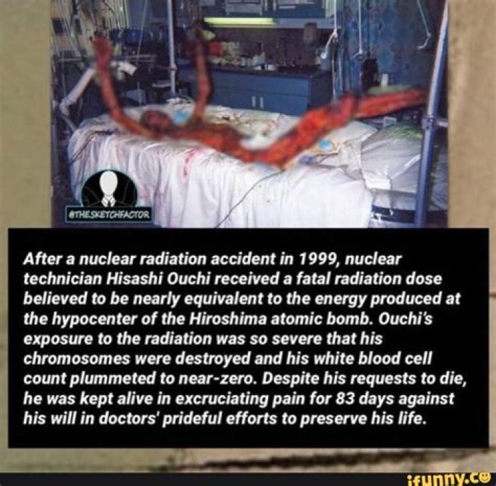 Hisashi Ouchi: A Survivor's Tale After Radiation Exposure