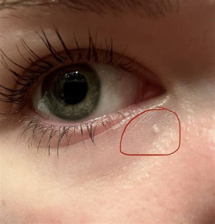 Unlocking The Secrets: The Bump-Bump-Bump Technique Is Used For